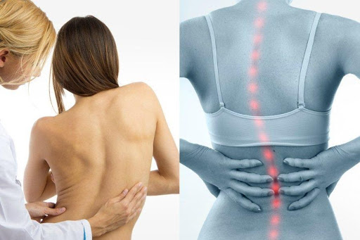 Сколиоз Сколиоз